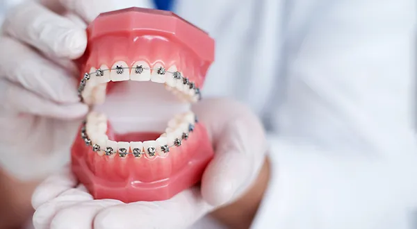 Common Orthodontic Problems and How to Fix Them