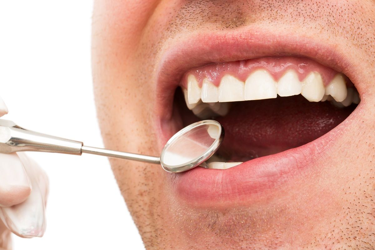 The Psychological Impact of a Gummy Smile: Tips for Boosting Self-Esteem
